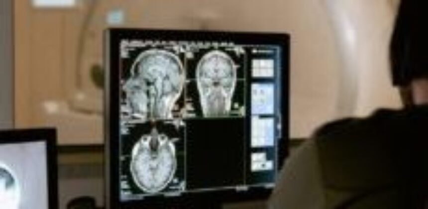 Long-Term Effects of Alcohol