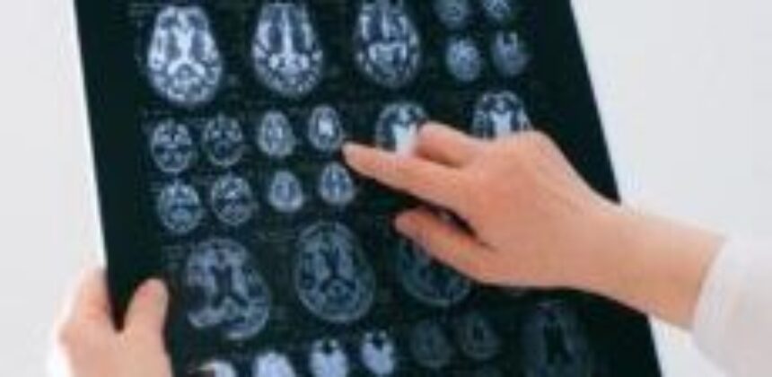 Effects of Alcohol on Mental Health