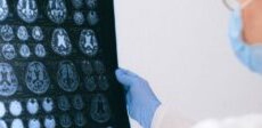 Can Fentanyl Cause Seizures